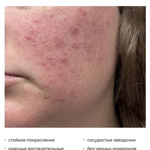 Экспертные консультации по уходу за кожей с японской и корейской косметикой